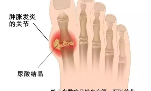 风心病会死人吗-风心病人胸闷气短网 :分享风心病人难受-风心病人胸闷气短吃什么药知识